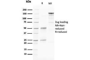 SDS-PAGE Analysis Purified PAPP-A Mouse Monoclonal Antibody (PAPPA/2716). (PAPPA 抗体  (AA 351-523))