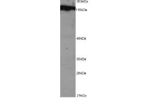 Image no. 1 for anti-Damage Specific DNA Binding Protein 1 (DDB1) (C-Term) antibody (ABIN374069) (DDB1 抗体  (C-Term))