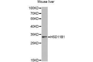 Western blot analysis of extracts of mouse liver, using HSD11B1 antibody.