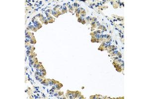 Immunohistochemistry (Paraffin-embedded Sections) (IHC (p)) image for anti-serpin Peptidase Inhibitor, Clade A (Alpha-1 Antiproteinase, Antitrypsin), Member 3 (SERPINA3) (AA 24-423) antibody (ABIN6147571)