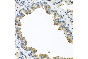 Immunohistochemistry of paraffin-embedded mouse lung using SERPINA3 antibody. (SERPINA3 抗体  (AA 24-423))