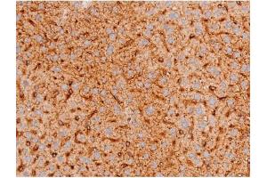 Immunohistochemistry (IHC) image for anti-Forkhead Box O4 (FOXO4) (pThr451) antibody (ABIN6256565)