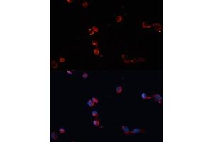 Immunofluorescence analysis of HeLa cells using Catalasealase antibody (ABIN6133450, ABIN6137987, ABIN6137989 and ABIN6215464) at dilution of 1:100. (Catalase 抗体  (AA 1-225))