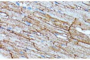 Immunohistochemistry of paraffin-embedded Rat heart using SLC14A1 Polyclonal Antibody at dilution of 1:100 (40x lens). (SLC14A1 抗体)