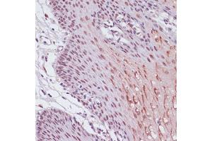 Immunohistochemistry of paraffin-embedded human esophageal using KDM1 antibody (ABIN7268323) at dilution of 1:100 (40x lens).