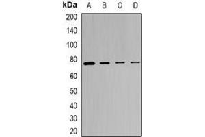 Western blot analysis of SRPK1 expression in MCF7 (A), Hela (B), mouse spleen (C), rat testis (D) whole cell lysates. (SRPK1 抗体)