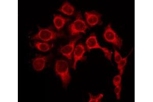 ABIN6268996 staining Hela by IF/ICC. (PRKACA 抗体  (Internal Region))