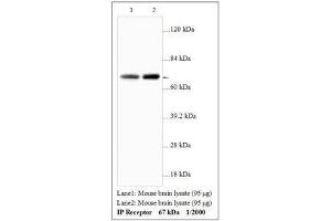 Image no. 1 for anti-Prostacyclin Receptor (PTGIR) antibody (ABIN791360) (Prostacyclin Receptor 抗体)