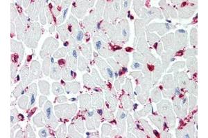 Human Heart (formalin-fixed, paraffin-embedded) stained with SIRT2at 5 µg/ml followed by biotinylated goat anti-rabbit IgG secondary antibody, alkaline phosphatase-streptavidin and chromogen. (SIRT2 抗体  (C-Term))