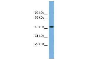 WB Suggested Anti-WDFY1 Antibody Titration: 0.