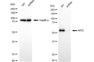 Western blotting analysis using AKT2 antibody (ABIN7800788). (AKT2 抗体)
