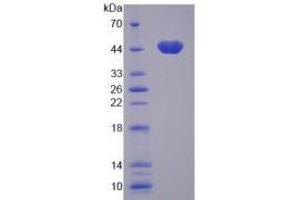 SDS-PAGE analysis of Human CAMK1 Protein. (CAMK1 蛋白)