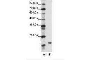 Image no. 1 for anti-TATA-Binding Protein-Associated Phosphoprotein (DR1) (N-Term) antibody (ABIN202041) (DR1 抗体  (N-Term))