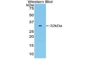 Western Blotting (WB) image for anti-Oncostatin M Receptor (OSMR) (AA 513-760) antibody (ABIN3206107) (Oncostatin M Receptor 抗体  (AA 513-760))