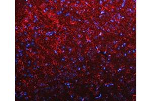 IF analysis of RIMBP2 using anti-RIMBP2 antibody (ABIN7601441). (RIMBP2 抗体  (AA 351-1049))