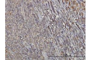 Image no. 1 for anti-RAB6A, Member RAS Oncogene Family (RAB6A) (AA 109-208) antibody (ABIN598568) (RAB6A 抗体  (AA 109-208))