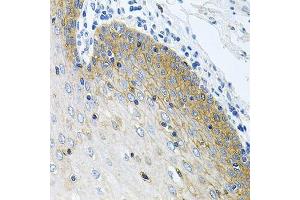 Immunohistochemistry of paraffin-embedded human esophagus using GNE antibody. (GNE 抗体  (AA 1-150))