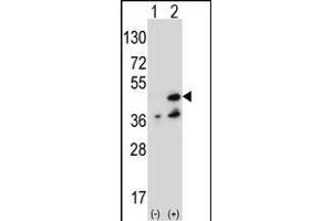 Western blot analysis of NME7 (arrow) using rabbit polyclonal NME7 Antibody (V40) (ABIN392659 and ABIN2842159). (NME7 抗体  (N-Term))