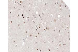 ABIN6266561 at 1/100 staining human brain tissue sections by IHC-P. (HDAC9 抗体  (C-Term))