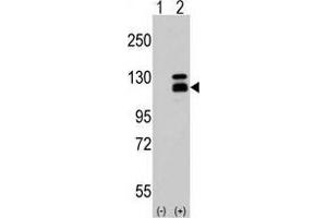 Western blot analysis of Parg Antibody (C-term) in 293 cell line lysates (35 µg/lane). (PARG 抗体  (C-Term))