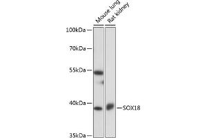 Western blot analysis of extracts of various cell lines, using SOX18 antibody (ABIN7270572) at 1:1000 dilution. (SOX18 抗体  (AA 1-100))