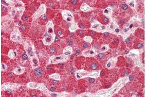 Human Liver: Formalin-Fixed, Paraffin-Embedded (FFPE) (DGCR8 抗体  (AA 180-229))