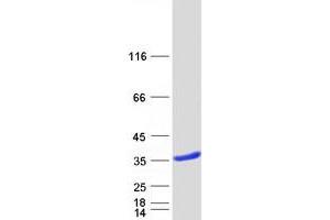 Validation with Western Blot
