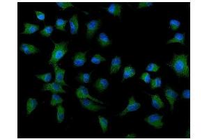 IF analysis of ATG9A using anti-ATG9A antibody (ABIN7599557). (ATG9A 抗体  (AA 1-812))
