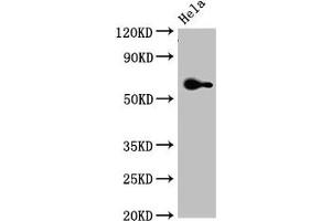 Western Blot Positive WB detected in: Hela whole cell lysate All lanes: FZD4 antibody at 3. (FZD4 抗体  (AA 37-222))