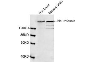 Western blot analysis of tissue lysates using 1 µg/mL Rabbit Anti-Neurofascin Polyclonal Antibody (ABIN398840) The signal was developed with IRDyeTM 800 Conjugated Goat Anti-Rabbit IgG. (NFASC 抗体  (N-Term))
