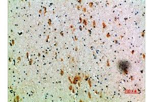 Immunohistochemical analysis of paraffin-embedded human-brain, antibody was diluted at 1:200 (KIR3DL2 抗体  (AA 221-270))