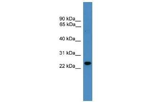 RAB9B antibody used at 0. (RAB9B 抗体  (N-Term))