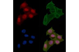 ABIN6257009 and ABIN6274409 staining Hela cells(24h of starvation treatment) by IF/ICC.