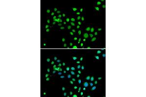 Immunofluorescence analysis of U2OS cells using macroH2A. (H2AFY 抗体  (AA 123-372))