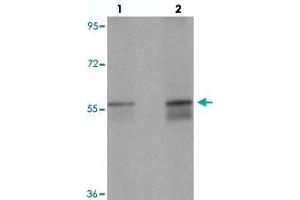 Western blot analysis of NETO1 in human lung tissue with NETO1 polyclonal antibody  at (lane 1) 1 and (lane 2) 2 ug/mL. (NETO1 抗体  (C-Term))