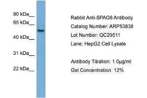 WB Suggested Anti-SPAG6  Antibody Titration: 0. (SPAG6 抗体  (Middle Region))