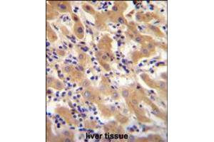 F11 Antibody immunohistochemistry analysis in formalin fixed and paraffin embedded human liver tissue followed by peroxidase conjugation of the secondary antibody and DAB staining. (Factor XI 抗体  (AA 281-307))