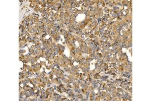 IHC analysis of MLX-interacting protein/MLXIP using anti-MLX-interacting protein/MLXIP antibody (ABIN7602593).