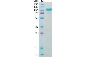 SDS-PAGE (SDS) image for alpha-Fetoprotein (AFP) (AA 19-609) protein (Fc Tag) (ABIN7092671)