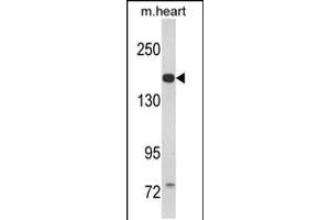 Western blot analysis of CORIN Antibody in mouse heart tissue lysates (35ug/lane)