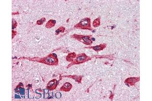 Immunohistochemistry (IHC) image for anti-Monoamine Oxidase B (MAOB) (Internal Region) antibody (ABIN185506)