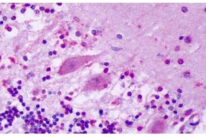 Anti-GPR1 antibody IHC staining of human brain, cerebellum, purkinje neurons. (G Protein-Coupled Receptor 1 抗体  (N-Term))