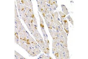 Immunohistochemistry of paraffin-embedded mouse heart using DSP antibody at dilution of 1:100 (40x lens). (Desmoplakin 抗体)