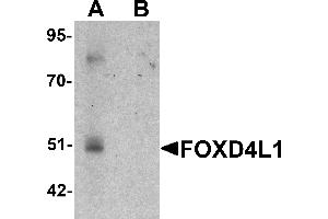 Western blot analysis of FOXD4L1 in A-20 cell lysate with FOXD4L1 antibody at 1 µg/mL in (A) the absence and (B) the presence of blocking peptide. (FOXD4L1 抗体  (C-Term))