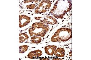 Immunohistochemistry (Paraffin-embedded Sections) (IHC (p)) image for anti-Catenin (Cadherin-Associated Protein), beta 1, 88kDa (CTNNB1) (AA 692-721), (C-Term) antibody (ABIN1881238)