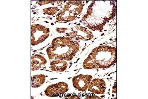 CTNNB1 Antibody (C-term) immunohistochemistry analysis in formalin fixed and paraffin embedded human stomach tissue followed by peroxidase conjugation of the secondary antibody and DAB staining. (CTNNB1 抗体  (C-Term))