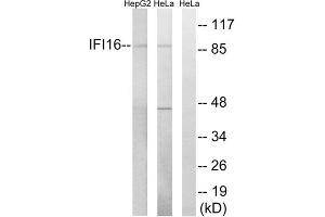 Western blot analysis of extracts from HeLa cells and HepG2 cells, using IFI16 antibody. (IFI16 抗体  (C-Term))