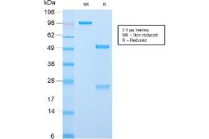 SDS-PAGE Analysis Purified ACTH Rabbit Recombinant Monoclonal Antibody (CLIP/2859R). (Recombinant POMC 抗体  (AA 25-39))