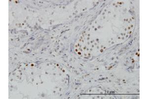 Immunoperoxidase of monoclonal antibody to BRD3 on formalin-fixed paraffin-embedded human testis.
