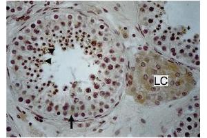 Immunohistochemistry image of Endothelin staining in paraffn sections of human testis. (Endothelin 1/2 抗体)